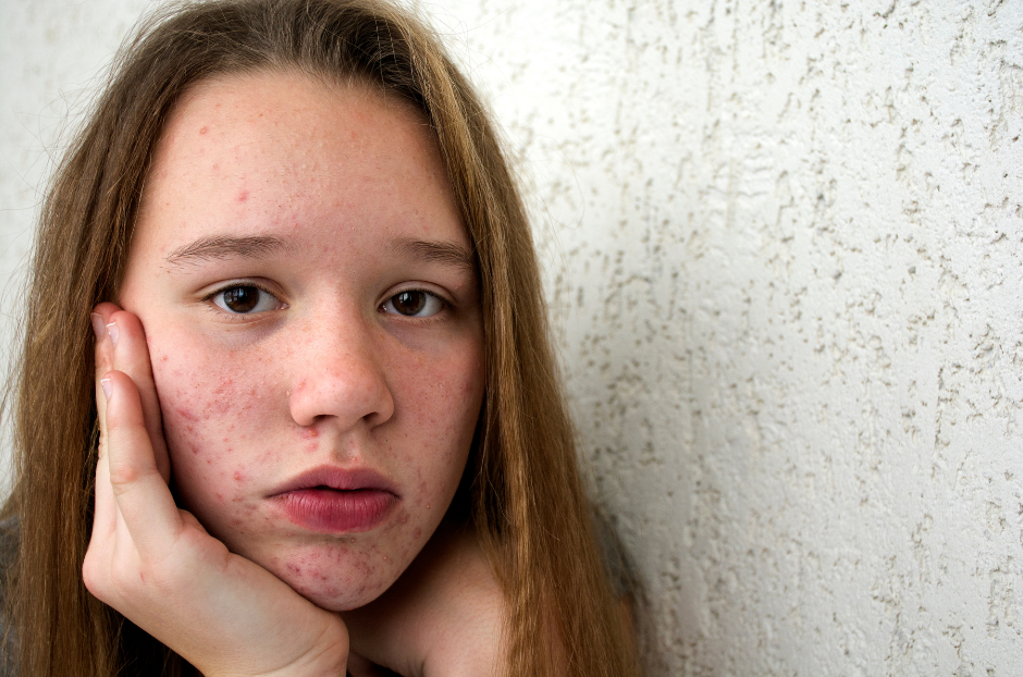 Young person managing juvenile arthritis